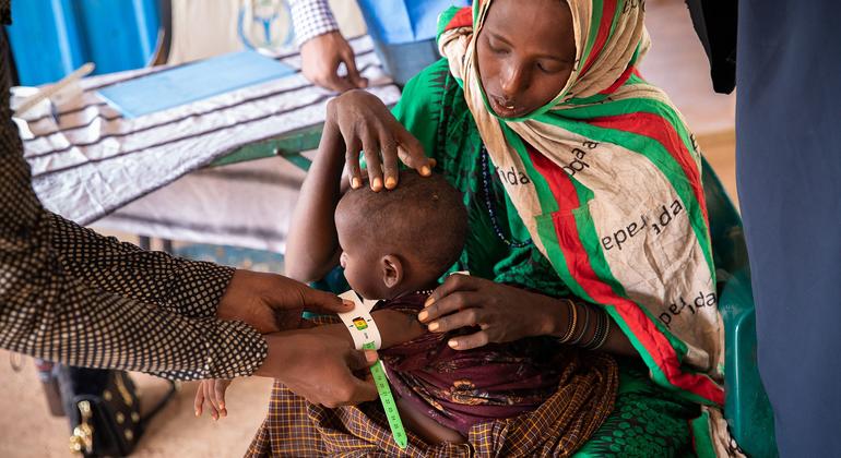 A one-year-old girl is treated for malnutrition at a WFP-funded clinic in Dolow in Somalia.